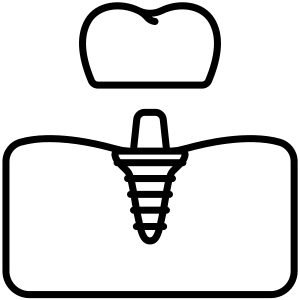 Implants service image
